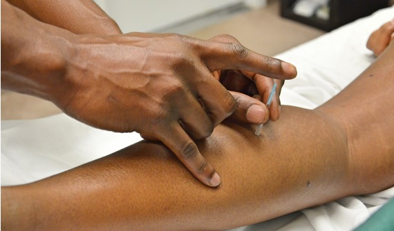DIU Acupuncture Scientifique